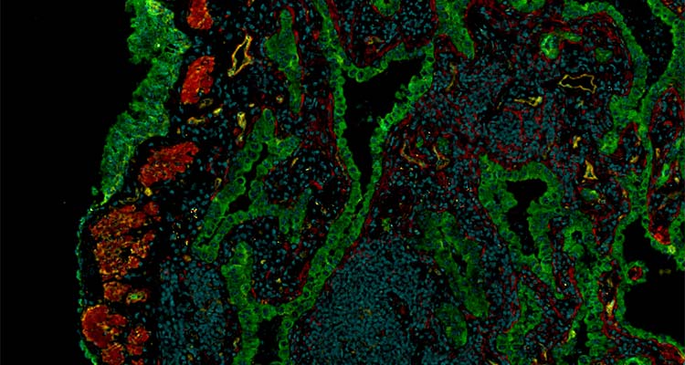 Image of immune cells